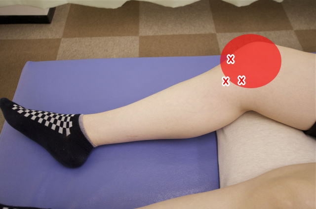 膝の内側の筋肉と膝蓋靱帯